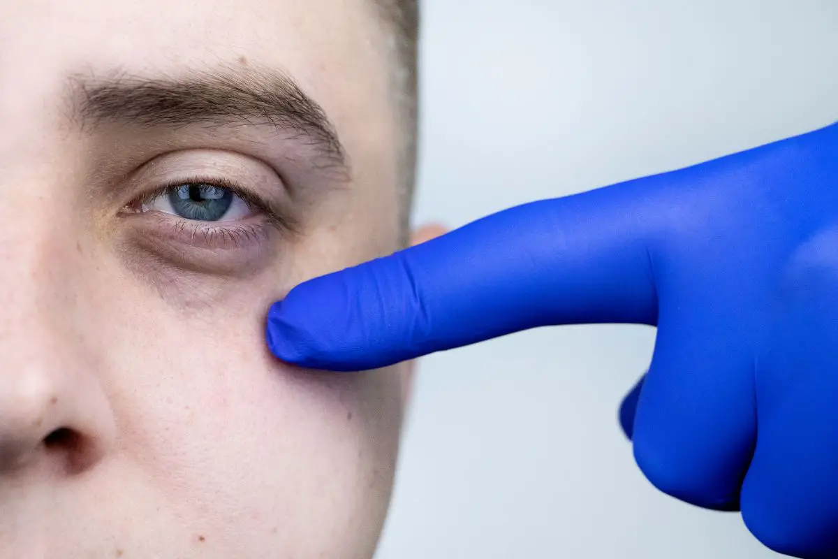 coffee grounds on eye bags