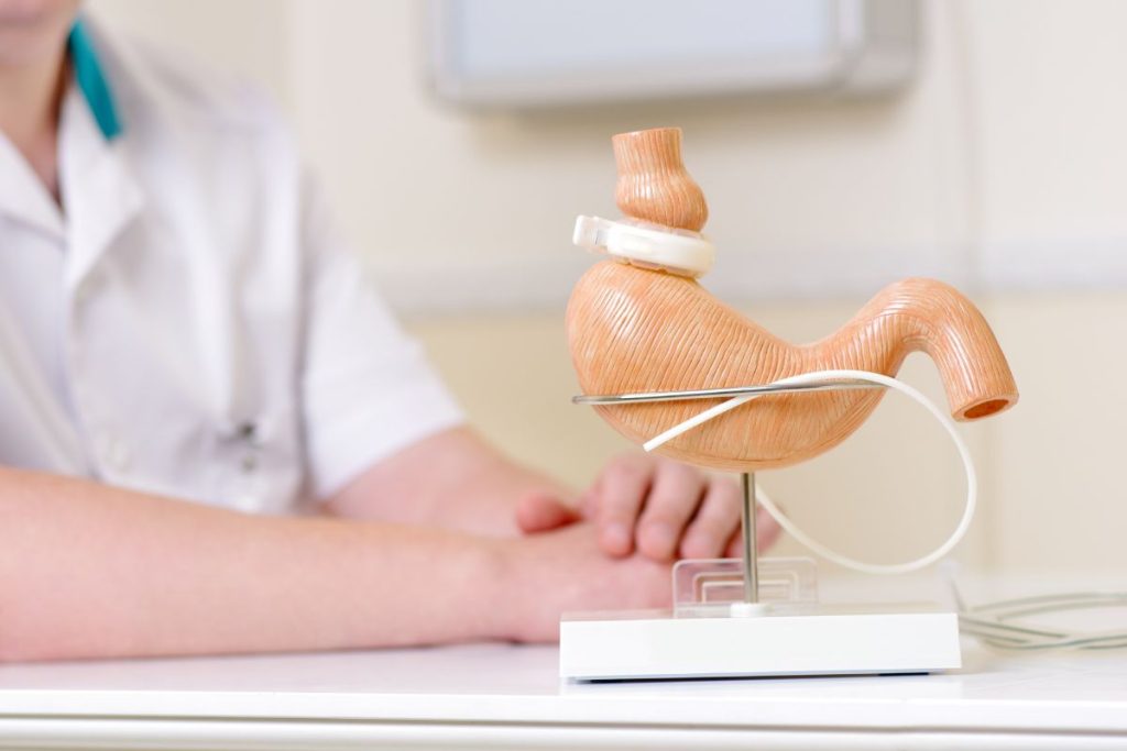 Can I Have Coffee After Bariatric Surgery Can i have coffee after bariatric surgery